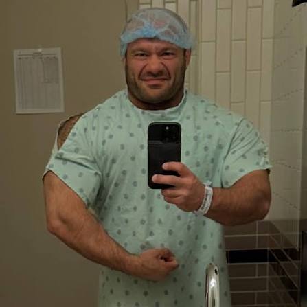Mike Israetel’s Cosmetic Surgery: Why He Chose It and How It Changed His Physique